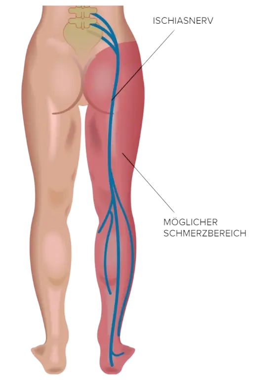 Anatomie des Ischiasnervs